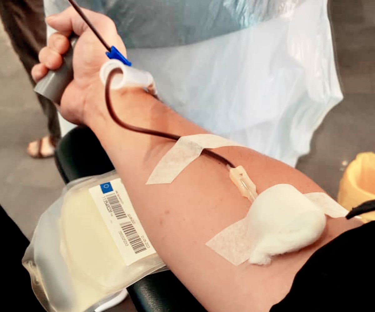 A close-up of fresh blood being drawn out via a catherer from a donor’s right arm during the process of blood donation